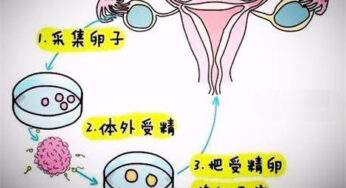 人工授精vs试管婴儿，有哪些不同之处？