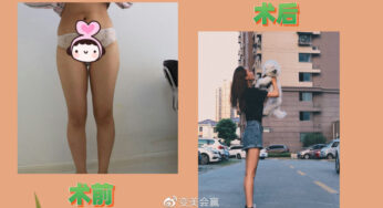 朋友说，这么美的腿，请问有谁不喜欢！