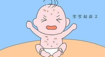 预防宝宝常见“高温病”，这些“知识点”很重要！