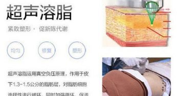 超声溶脂是什么？效果怎么样？