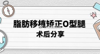 脂肪移植矫正O型腿