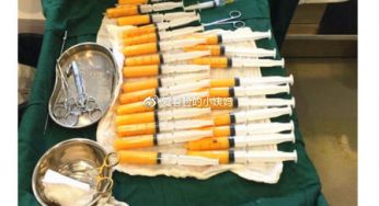 想做脂肪填充？纳米脂肪、脂肪胶、PRP搞清楚先！