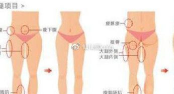 想做大腿吸脂，选择共振吸脂和水动力吸脂哪个更好？