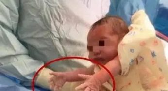 “粘人宝宝”火了，刚出生就要妈妈抱抱，医生：想拦都拦不住