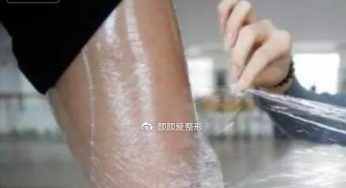 网上保鲜膜减肥正确使用方法别看了 想快速瘦还得靠吸脂