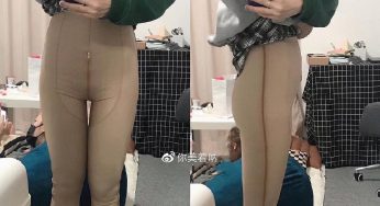 妈妈臀抽脂多久可以坐？有几个切口和部位